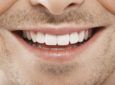 Zahnästhetik: Schönheit und Funktion vereint